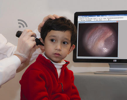 V�deo Otoscopio Digital Inal�mbrico DE550